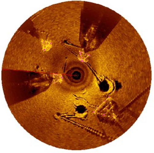 Sonar Image 3